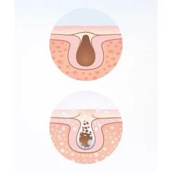 Ansiktssauna Lanaform Facial Care